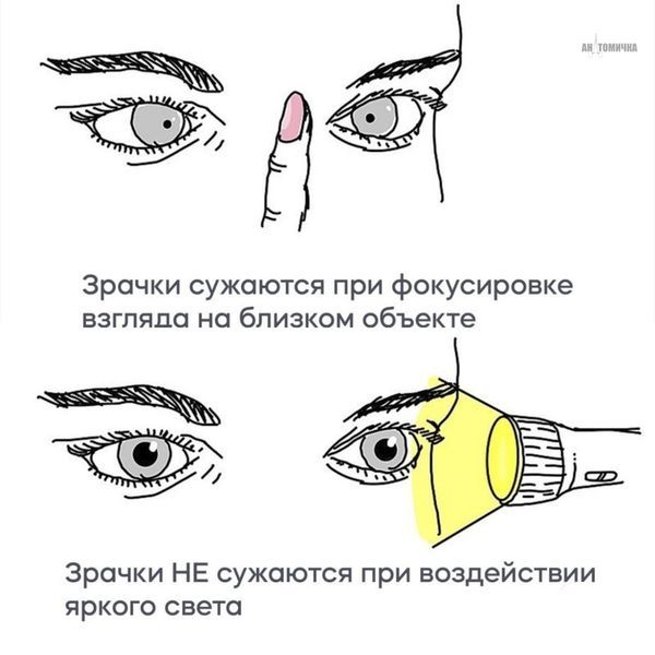 Симптом Аргайла Робертсона