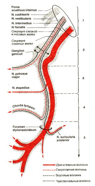 Схема лицевого и промежуточного нервов. 1-5 — уровни поражения нерва