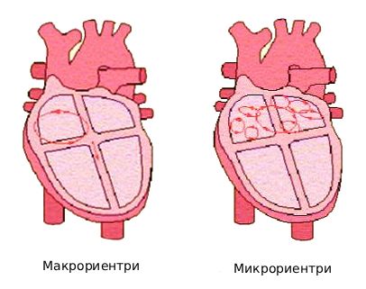 Виды риентри