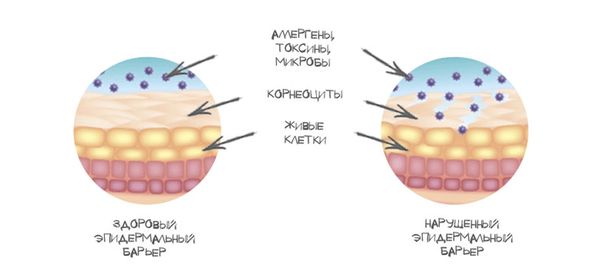 Проникновение патогенов Проникновение патогенов
