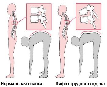 Тест Адамса