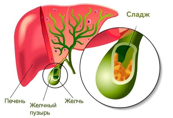 Сладж
