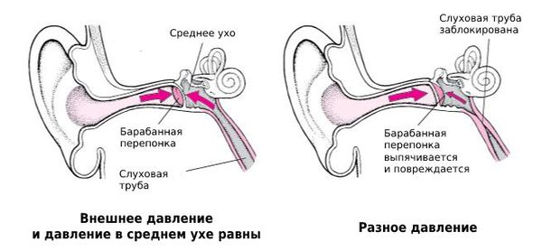 Выравнивание разницы давления слуховой трубой