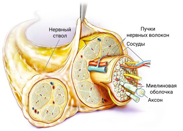 Строение здорового нерва