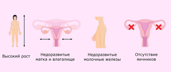 Симптомы при синдроме Свайера Симптомы при синдроме Свайера