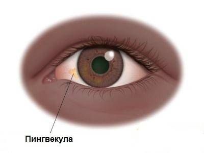 Пингвекула