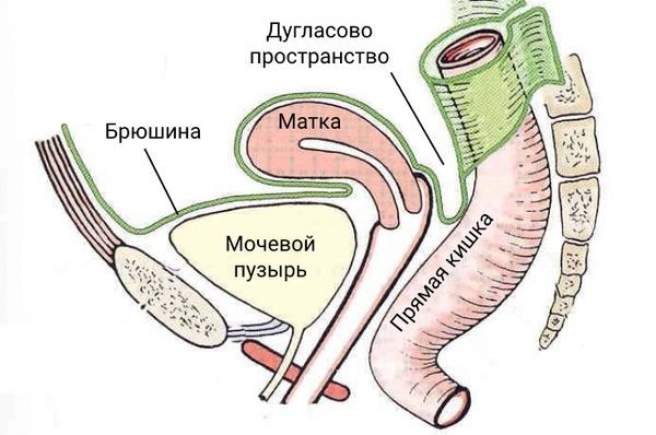 Метроэндометрит - симптомы, причины и лечение