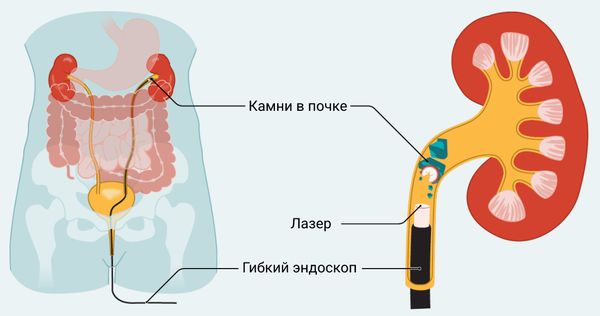 Просмотр статьи