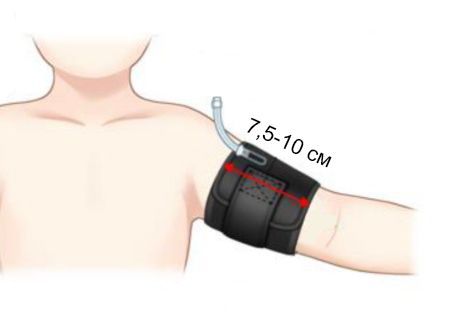 Пневматический жгут