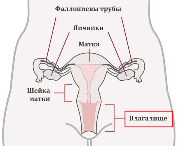 Расположение полипов влагалища