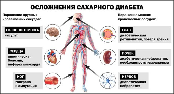 Осложнения сахарного диабета