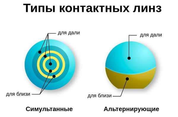 Типы мультифокальных контактных линз