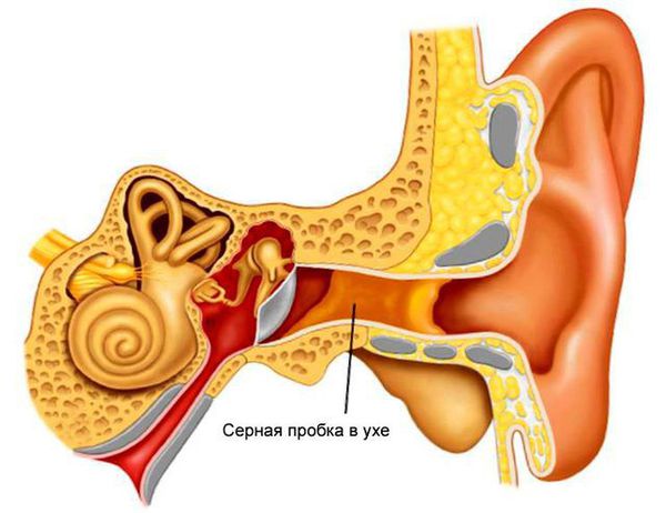 какое лекарство растворяет пробки в ушах