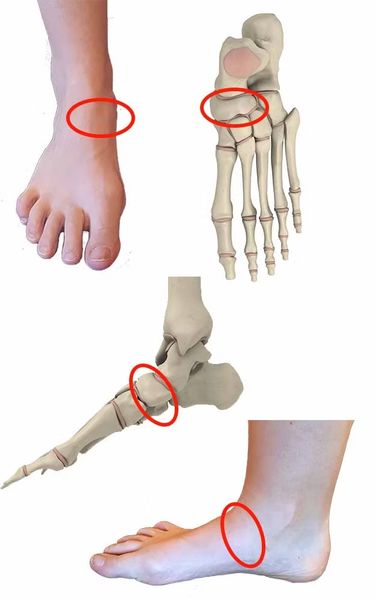 Ладьевидная кость [20]