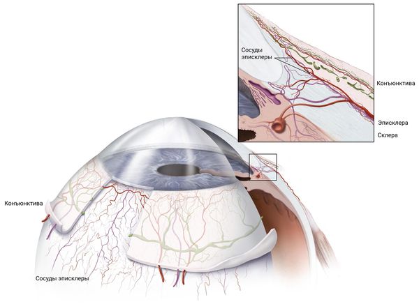 Эписклера Эписклера