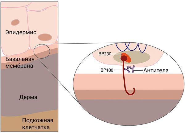 Схема соединения эпидермиса и дермы (белки BP180 и BP230) [24]