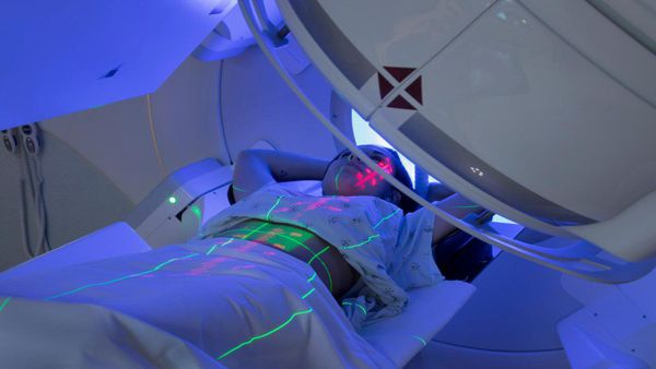 Radiation therapy for pancreatic cancer