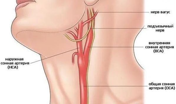 Сонная артерия Сонная артерия