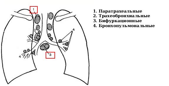Расположение паратрахеальных и бифуркационных лимфоузлов