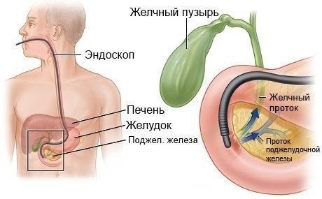 ЭРХПГ ЭРХПГ