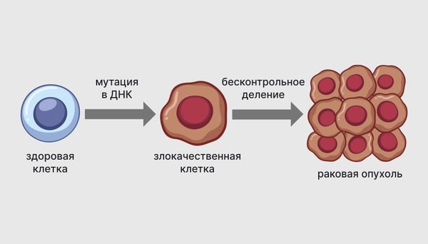Озлокачествление клеток Озлокачествление клеток