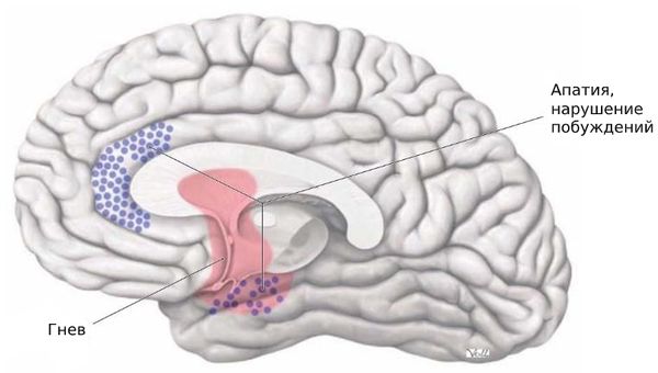 Поражение структур лимбической системы мозга (передней части поясной извилины, ядер прозрачной перегородки, ядер гипоталамуса, гиппокампальной коры), приводящее к эмоциональным и поведенческим расстройствам [16]