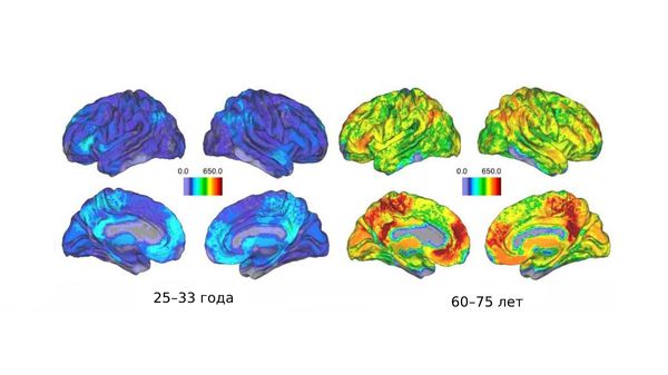 Снимки МРТ: активность мозга в течение жизни [16]
