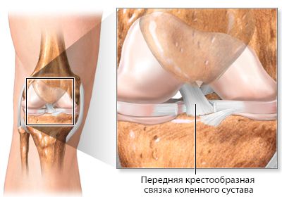Передняя крестообразная связка коленного сустава