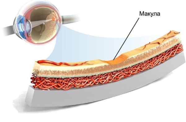 Макула