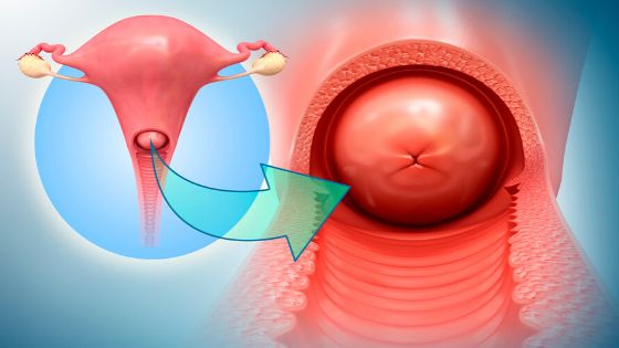 Шейка матки