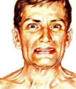 Спазм лица при столбняке