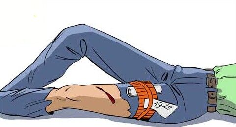 Жгут с указанием времени