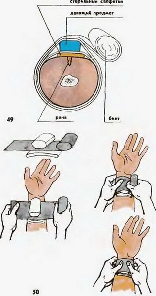 Даваящая повязка Даваящая повязка