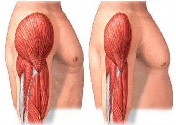 Мышцы в норме и при саркопении