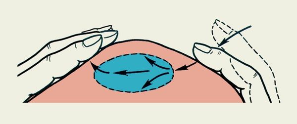 Флюктуация