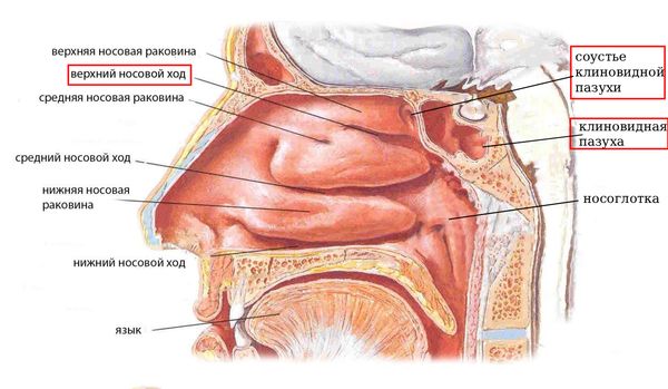 Сообщение клиновидной пазухи с верхним носовым ходом