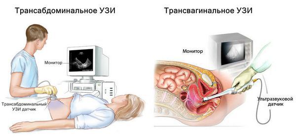 Хотите опередить порно — начинайте говорить с детьми о сексе как можно раньше