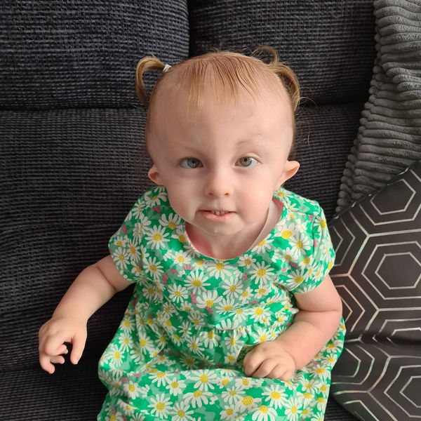 Ребёнок с синдромом Эдвардса [21]