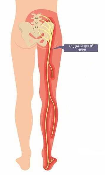 Область тела, которую иннервирует седалищный нерв