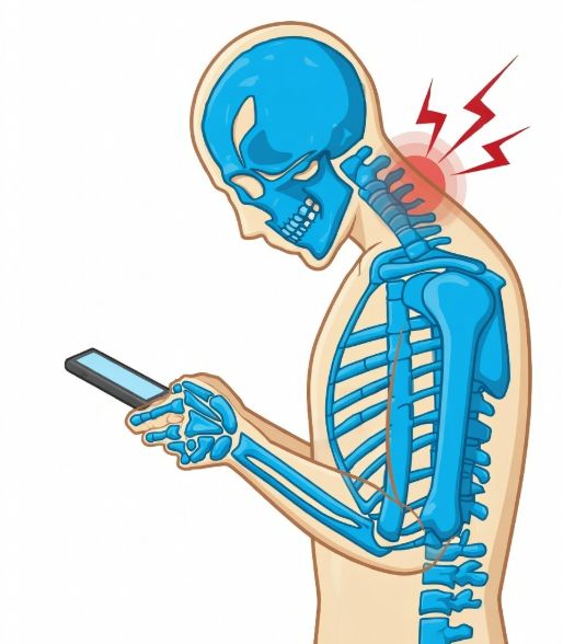 Синдром компьютерной шеи