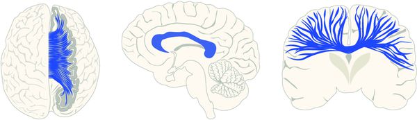 Мозолистое тело в разных проекциях