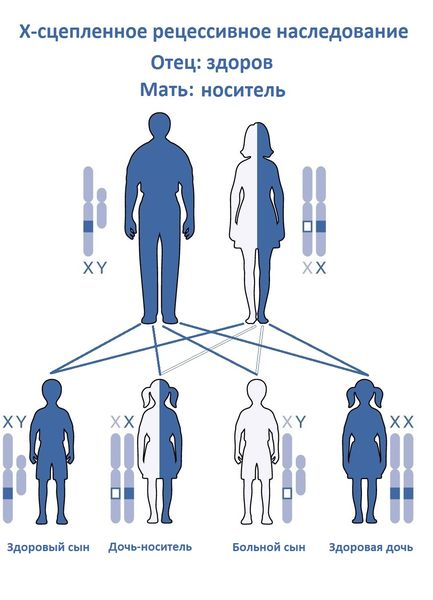  Х-сцепленный рецессивный тип наследования