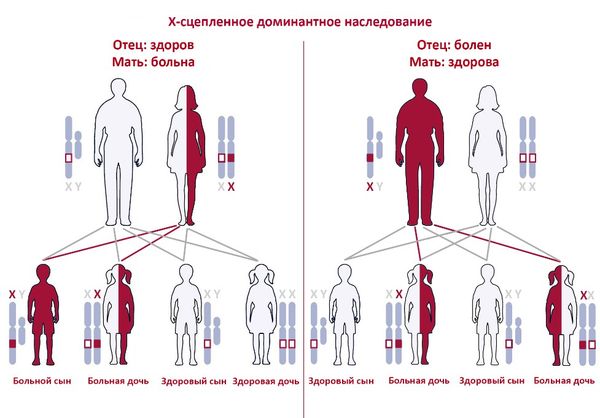 Тип наследования синдрома
