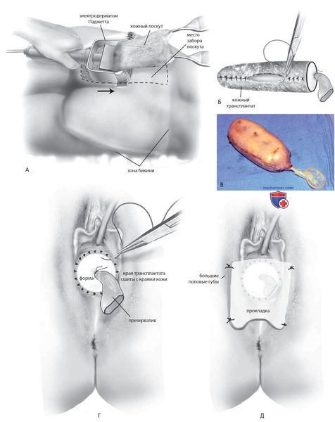 Vagina dentata — Википедия