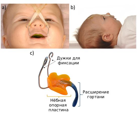 PEBP-пластинка [16]