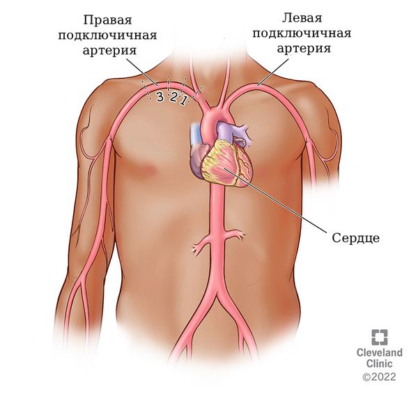 Расположение подключичных артерий [24]
