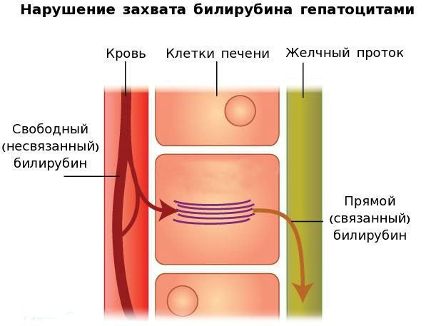 Жильбера или жильбера ударение