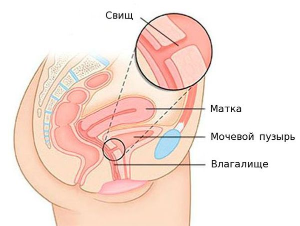 Широкое влагалище. Как сузить широкое влагалище?