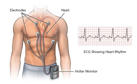 Учащенный пульс и сердцебиение причины что делать