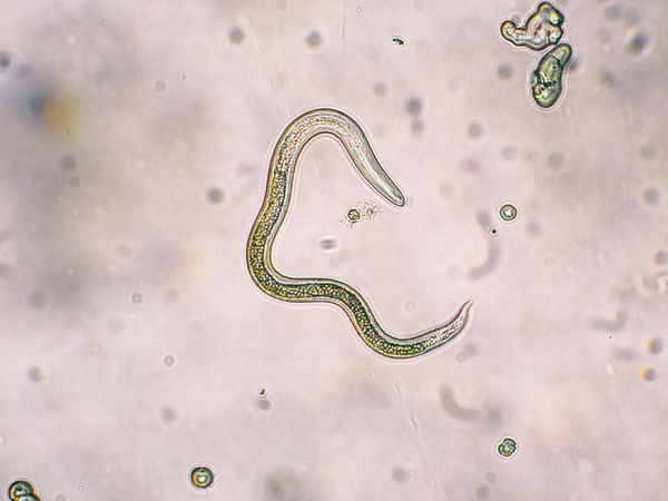 Червь Toxocara canis под микроскопом